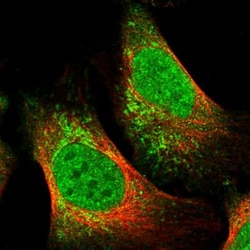Trinucleotide Repeat Containing 18 Antibody, Novus Biologicals 0.1mL; Unlabeled:Antibodies,
